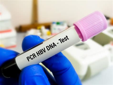 hbv dna test price philippines|HBV DNA Quantitative, Quantitative PCR .